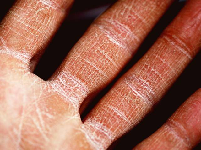 7 Common Skin Disorders and Their Treatment