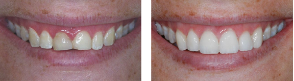 Cosmetic Dentistry