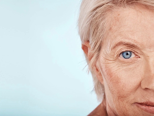 What Perimenopause Does to Your Eyes & What You Can Do About It