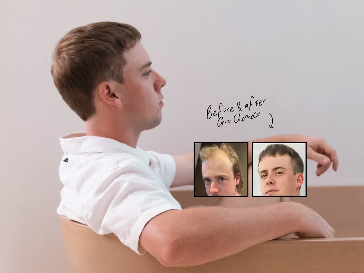 Balding, Breakage & Beards: A Woman's Guide to Men's Hair Health