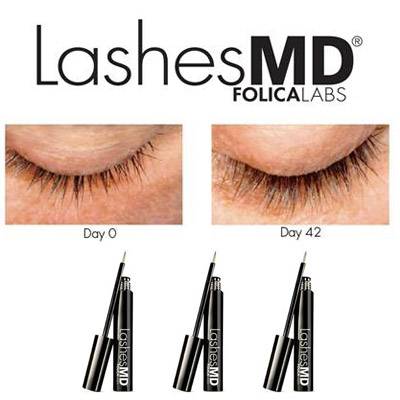 LashesMD