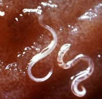 Viermi pinworms viermi pinworms, Pinworms de giardia pinworm, Diagnosis b80 enterobiasis
