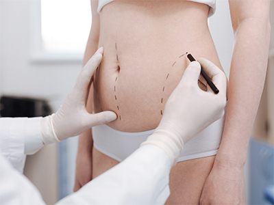 Intent good plastic surgeon consulting his patient on liposuction
